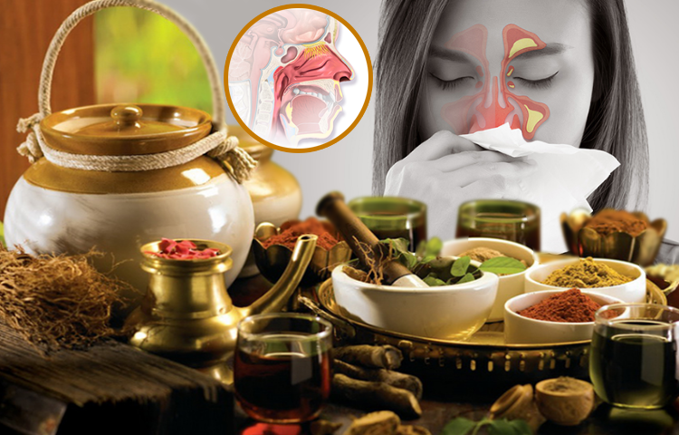 Điều trị viêm mũi xoang theo Y học cổ truyền